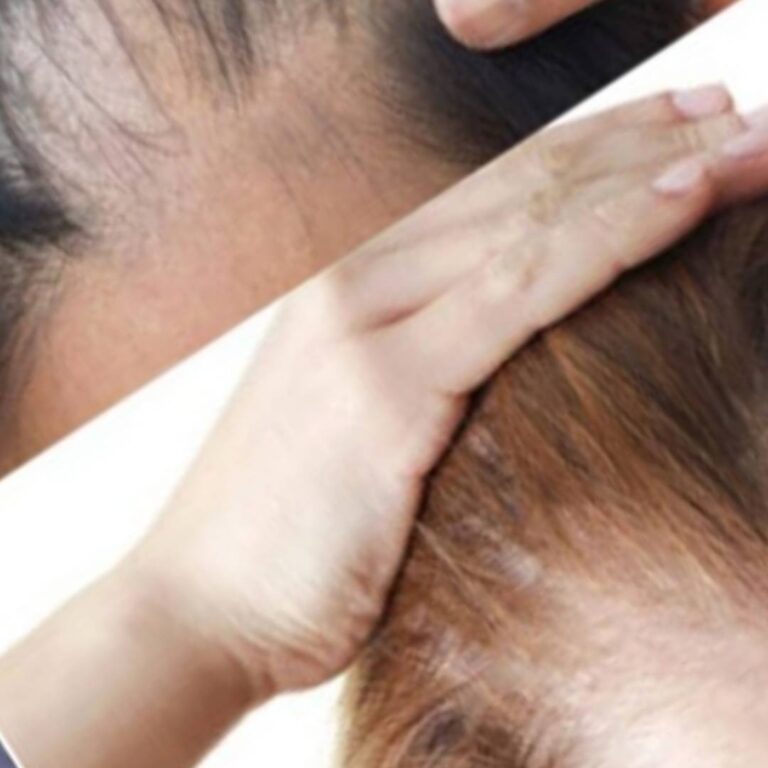 Grandma’s Secret Flax Seed That Changed My Hair Growth Completely